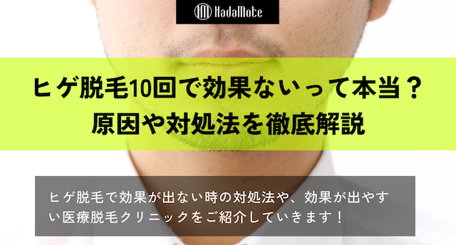 ヒゲ脱毛　10回　効果ないのサムネイル