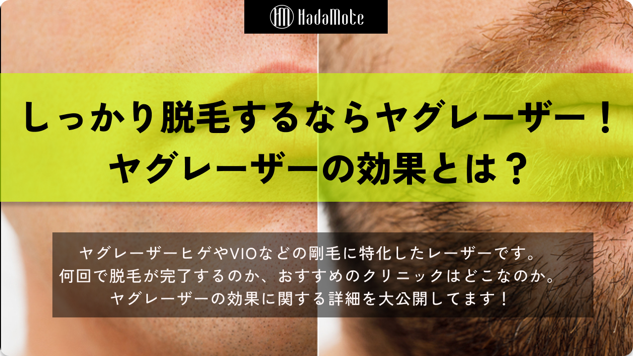 ヤグレーザー　効果のサムネイル