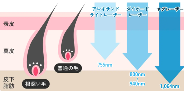 エミナルクリニックの脱毛機レーザー紹介画像