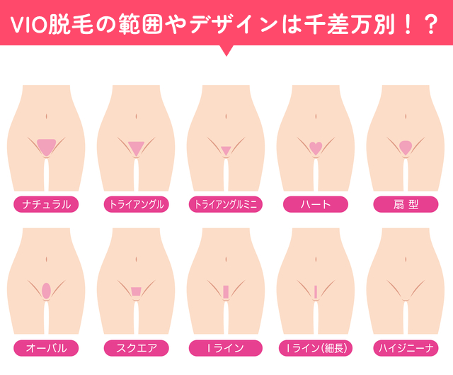 vio脱毛のデザイン種類の画像