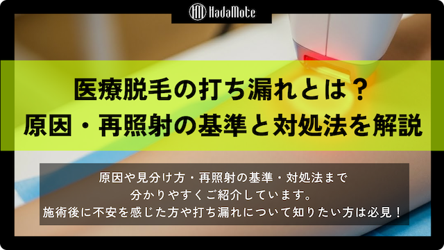 医療脱毛の打ち漏れとは？原因・再照射の基準と正しい対処法を解説画像