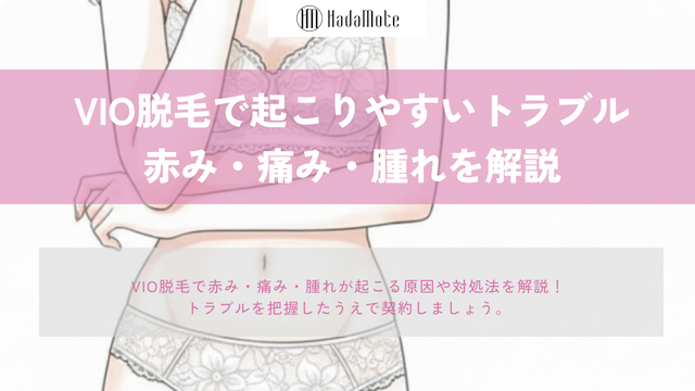 VIO脱毛で起こりやすいトラブルを解説｜赤み・痛み・腫れの原因と対処法のサムネイル
