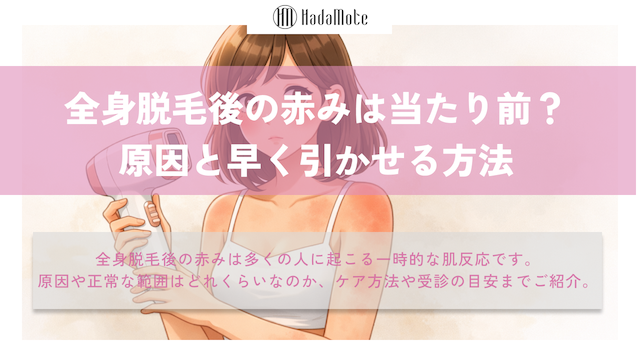全身脱毛後の赤みは普通？早く引かせる方法　のサムネイル